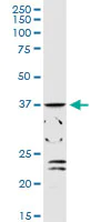 Western blot - Anti-ADH1C antibody (AB168748)
