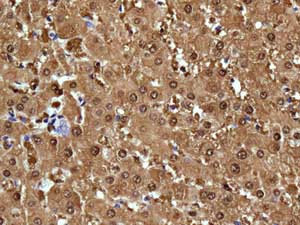 Immunohistochemistry (Formalin/PFA-fixed paraffin-embedded sections) - Anti-ADH4 antibody [EPR9483] (AB137077), expandable thumbnail