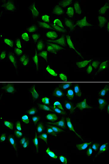 Immunocytochemistry/ Immunofluorescence - Anti-ADH5 antibody (AB175406)