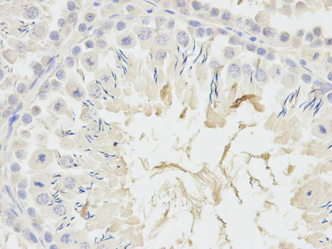 Immunohistochemistry (Formalin/PFA-fixed paraffin-embedded sections) - Anti-ADH5 antibody (AB175406)