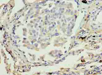 Immunohistochemistry (Formalin/PFA-fixed paraffin-embedded sections) - Anti-ADH7 antibody (AB236767)