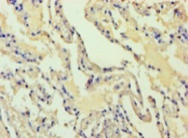 Immunohistochemistry (Formalin/PFA-fixed paraffin-embedded sections) - Anti-ADH7 antibody (AB236767)