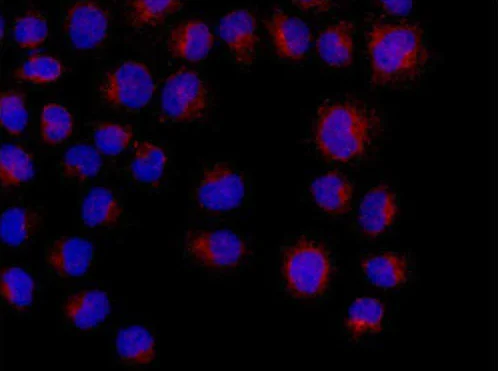 Immunocytochemistry/ Immunofluorescence - Anti-ADH7 antibody [EPR13949] (AB186408)