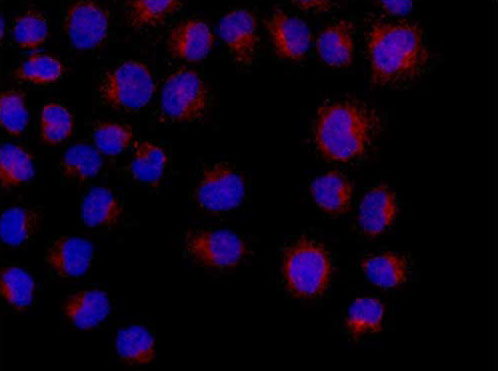 Immunocytochemistry/ Immunofluorescence - Anti-ADH7 antibody [EPR13949] - BSA and Azide free (AB250872), expandable thumbnail