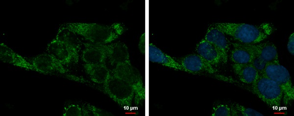 Immunocytochemistry/ Immunofluorescence - Anti-ADHFE1 antibody (AB229146)