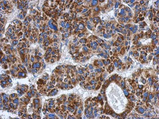 Immunohistochemistry (Formalin/PFA-fixed paraffin-embedded sections) - Anti-ADHFE1 antibody (AB229146)