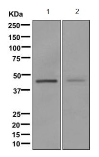 Western blot - Anti-ADHFE1 antibody [EPR12501] (AB173530), expandable thumbnail