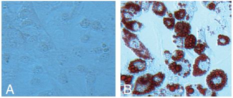 Functional Studies - Adipogenesis Assay Kit (Cell-Based) (AB133102)