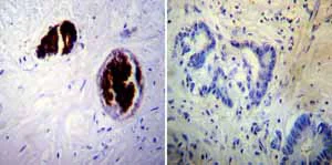 Immunohistochemistry (Formalin/PFA-fixed paraffin-embedded sections) - Anti-Adiponectin antibody [19F1] (AB22554)
