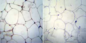 Immunohistochemistry (Formalin/PFA-fixed paraffin-embedded sections) - Anti-Adiponectin antibody [19F1] (AB22554)