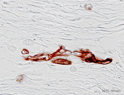 Immunohistochemistry (Formalin/PFA-fixed paraffin-embedded sections) - Anti-Adiponectin antibody [19F1] (AB22554)