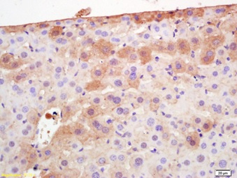 Immunohistochemistry (Formalin/PFA-fixed paraffin-embedded sections) - Anti-Adiponectin antibody (AB216502), expandable thumbnail