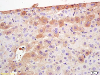Immunohistochemistry (Formalin/PFA-fixed paraffin-embedded sections) - Anti-Adiponectin antibody (AB216502)