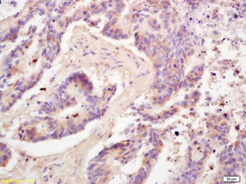 Immunohistochemistry (Formalin/PFA-fixed paraffin-embedded sections) - Anti-Adiponectin antibody (ab216502), expandable thumbnail