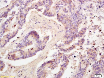 Immunohistochemistry (Formalin/PFA-fixed paraffin-embedded sections) - Anti-Adiponectin antibody (AB216502)