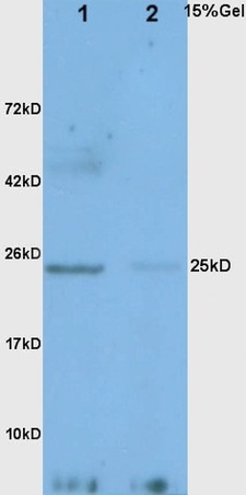 Western blot - Anti-Adiponectin antibody (AB216502), expandable thumbnail