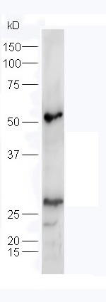 Western blot - Anti-Adiponectin antibody (AB216502), expandable thumbnail