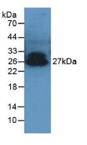 Western blot - Anti-Adiponectin antibody (AB231100)