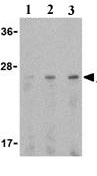 Western blot - Anti-Adiponectin antibody (AB25891)