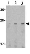 Western blot - Anti-Adiponectin antibody (AB25891)