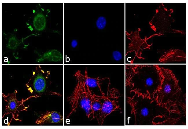 Immunocytochemistry - Anti-Adiponectin antibody (AB3455)