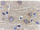 Immunohistochemistry (Formalin/PFA-fixed paraffin-embedded sections) - Anti-Adiponectin antibody (AB62551), expandable thumbnail