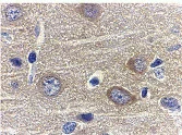 Immunohistochemistry (Formalin/PFA-fixed paraffin-embedded sections) - Anti-Adiponectin antibody (AB62551)