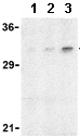 Western blot - Anti-Adiponectin antibody (AB62551), expandable thumbnail