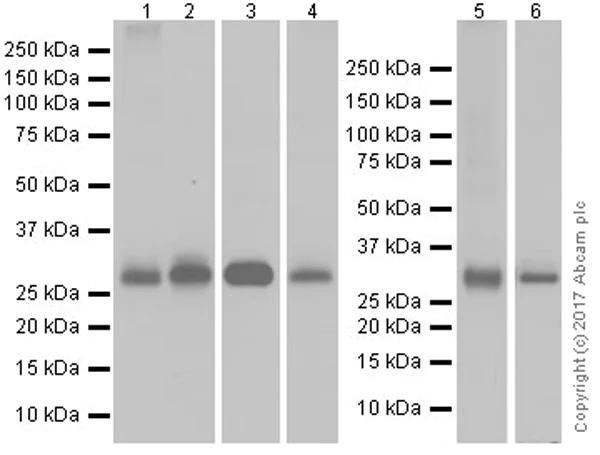 Western blot - Anti-Adiponectin antibody [EPR17019] (AB181281)