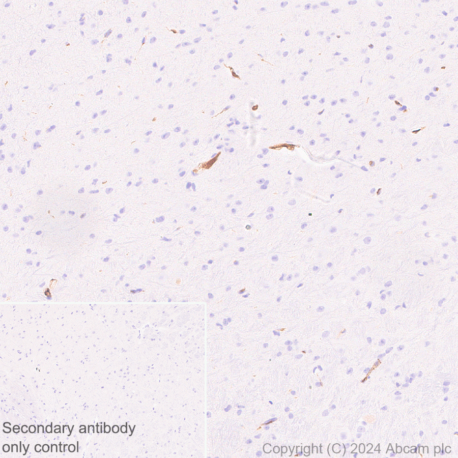 Immunohistochemistry (Formalin/PFA-fixed paraffin-embedded sections) - Anti-Adiponectin antibody [RM1203] (AB317847), expandable thumbnail