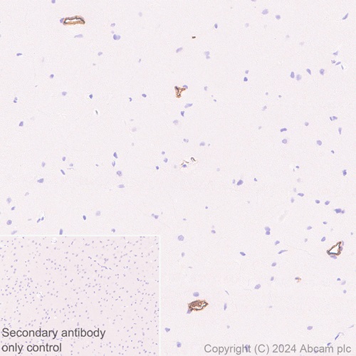 Immunohistochemistry (Formalin/PFA-fixed paraffin-embedded sections) - Anti-Adiponectin antibody [RM1203] (AB317847), expandable thumbnail