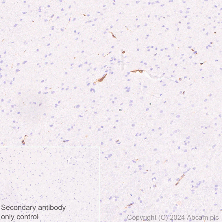Immunohistochemistry (Formalin/PFA-fixed paraffin-embedded sections) - Anti-Adiponectin antibody [RM1203] - BSA and Azide free (AB317848)