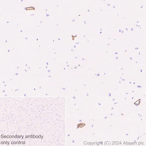 Immunohistochemistry (Formalin/PFA-fixed paraffin-embedded sections) - Anti-Adiponectin antibody [RM1203] - BSA and Azide free (AB317848)