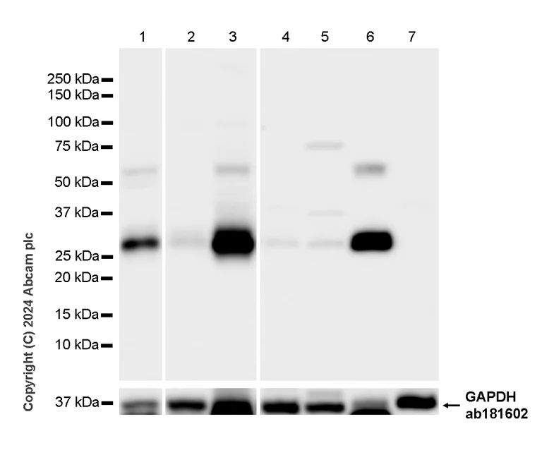 Western blot - Anti-Adiponectin antibody [RM1203] - BSA and Azide free (AB317848)