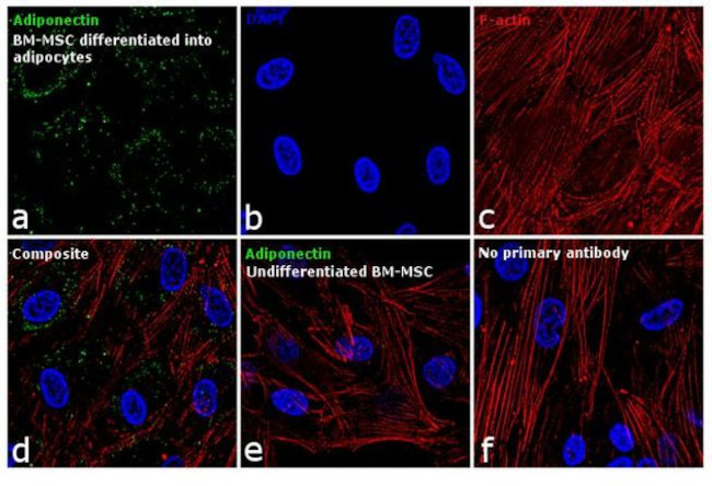 Immunocytochemistry/ Immunofluorescence - Anti-Adiponectin Antibody [RP23040035] (AB313402)