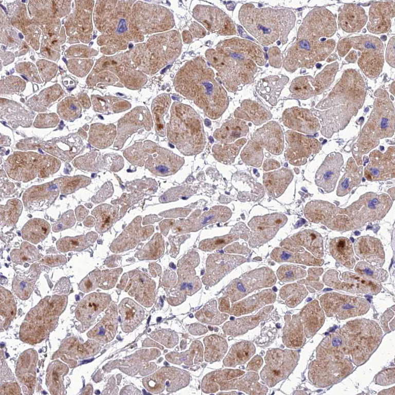 Immunohistochemistry (Formalin/PFA-fixed paraffin-embedded sections) - Anti-Adiponectin Receptor 2/ADIPOR2 antibody (AB223752)