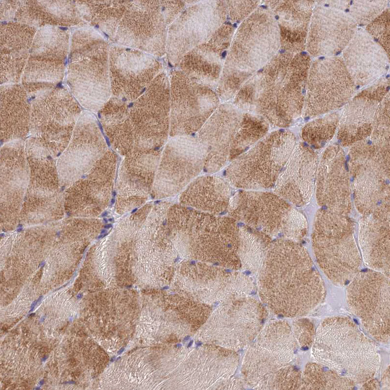 Immunohistochemistry (Formalin/PFA-fixed paraffin-embedded sections) - Anti-Adiponectin Receptor 2/ADIPOR2 antibody (AB223752)