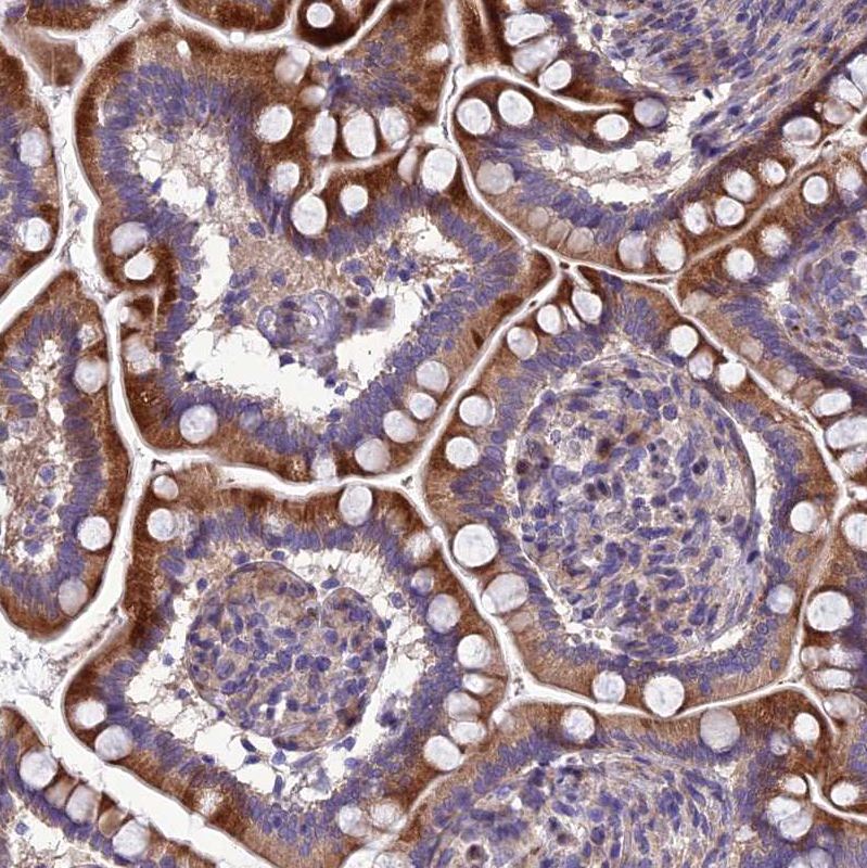 Immunohistochemistry (Formalin/PFA-fixed paraffin-embedded sections) - Anti-Adiponectin Receptor 2/ADIPOR2 antibody (AB223752)