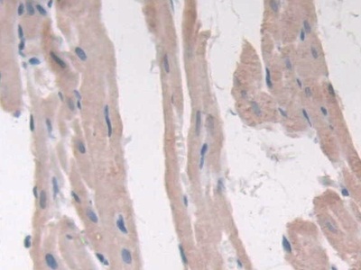 Immunohistochemistry (Formalin/PFA-fixed paraffin-embedded sections) - Anti-Adiponectin Receptor 2/ADIPOR2 antibody (AB231051)