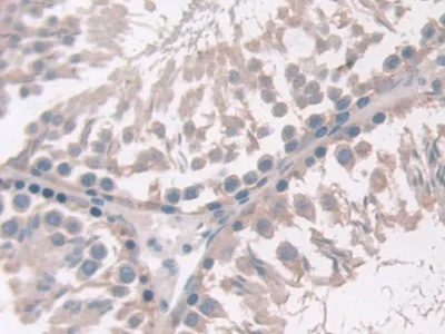 Immunohistochemistry (Formalin/PFA-fixed paraffin-embedded sections) - Anti-Adiponectin Receptor 2/ADIPOR2 antibody (AB231051)