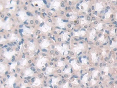 Immunohistochemistry (Formalin/PFA-fixed paraffin-embedded sections) - Anti-Adiponectin Receptor 2/ADIPOR2 antibody (AB231051)