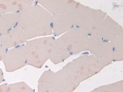 Immunohistochemistry (Formalin/PFA-fixed paraffin-embedded sections) - Anti-Adiponectin Receptor 2/ADIPOR2 antibody (AB231051)