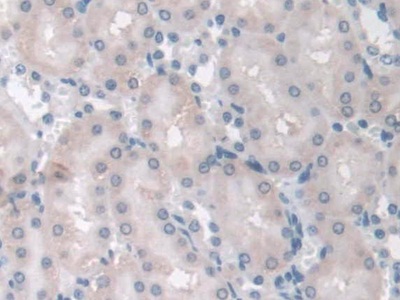 Immunohistochemistry (Formalin/PFA-fixed paraffin-embedded sections) - Anti-Adiponectin Receptor 2/ADIPOR2 antibody (AB231051)