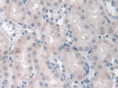 Immunohistochemistry (Formalin/PFA-fixed paraffin-embedded sections) - Anti-Adiponectin Receptor 2/ADIPOR2 antibody (AB231051)