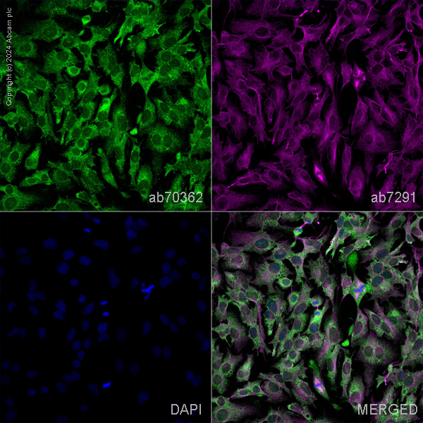 Immunocytochemistry/ Immunofluorescence - Anti-ADIPOR1 antibody (AB70362)