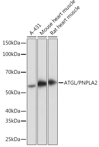 Western blot - Anti-Adipose Triglyceride Lipase antibody [10Y4M10] (AB302885)