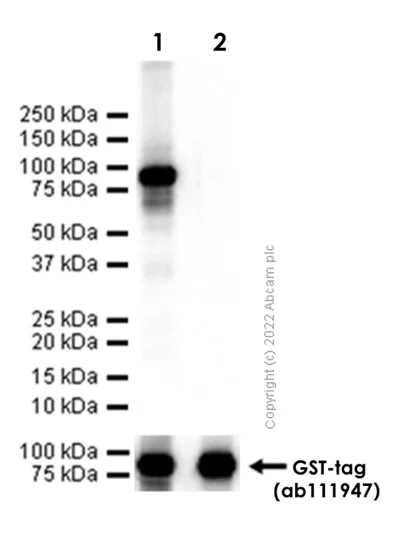 Western blot - Anti-Adipose Triglyceride Lipase antibody [EPR19650] (AB207799)