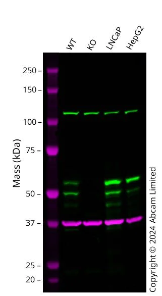 Western blot - Anti-Adipose Triglyceride Lipase antibody [EPR19650] (AB207799)