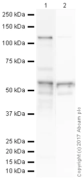 Western blot - Anti-Adipose Triglyceride Lipase antibody [EPR19650] (AB207799)