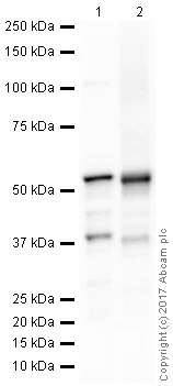 Western blot - Anti-Adipose Triglyceride Lipase antibody [EPR19650] (AB207799)